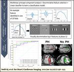 A machine learning cardiac magnetic resonance approach to extract disease features and automate pulmonary arterial hypertension diagnosis