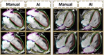 Development and validation of AI-derived segmentation of four-chamber cine cardiac magnetic resonance